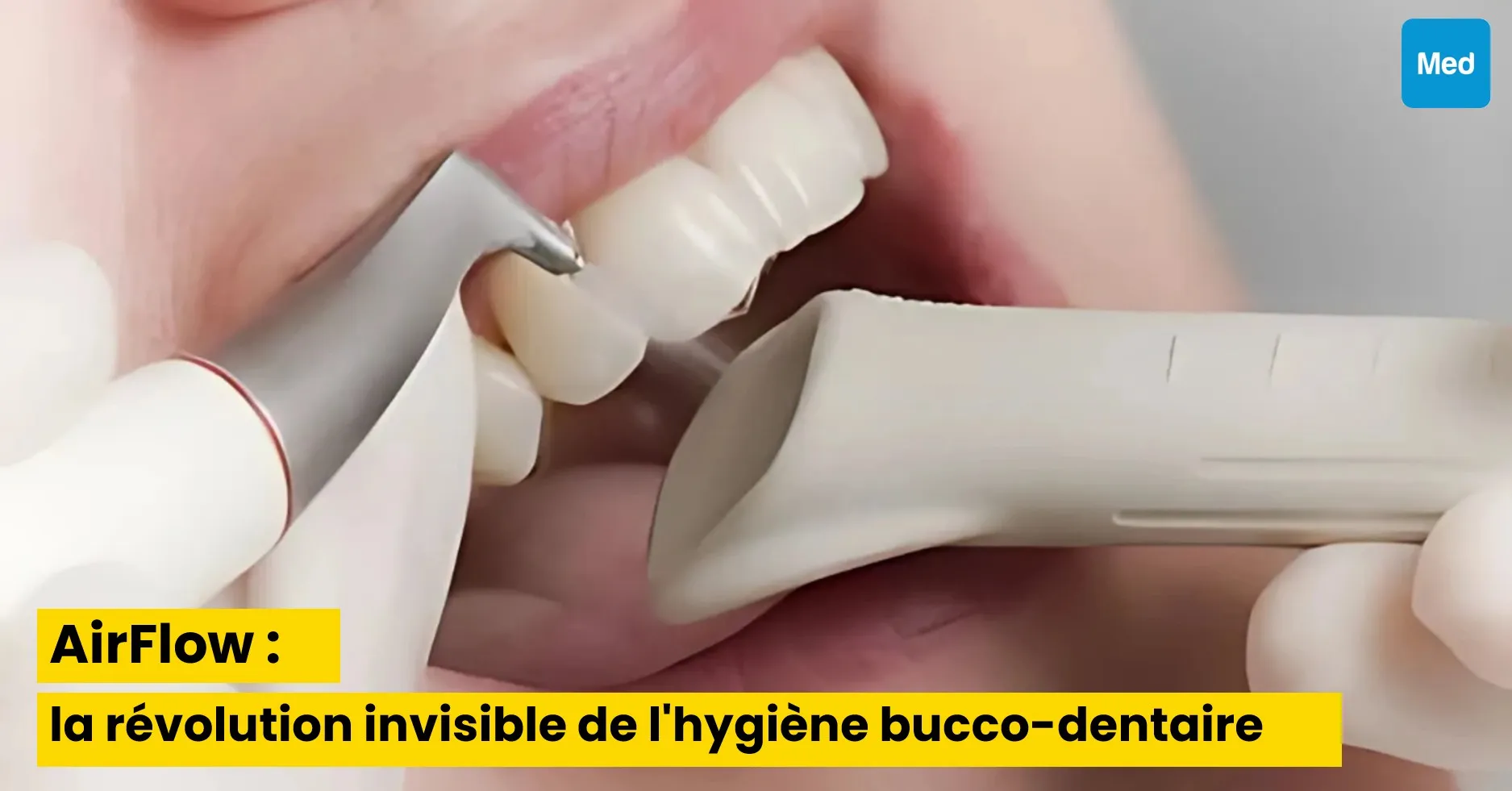 AirFlow : la révolution invisible de l'hygiène bucco-dentaire